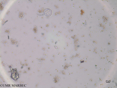 phyto/Brazilian_Nordeste/Northeastcoast_station43/ABRACOS1 October 2015/Mastogloia sp2 (st40_12_dino_navicula_spx170811_001_ovl)(copy)_thumb.jpg